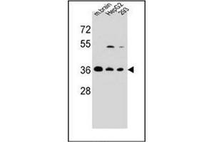 Western blot analysis of FBXO2 Antibody (FBXO2 Antikörper  (C-Term))