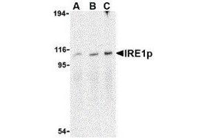 Western Blotting (WB) image for anti-Endoplasmic Reticulum To Nucleus Signaling 1 (ERN1) (C-Term) antibody (ABIN2475138) (ERN1 Antikörper  (C-Term))