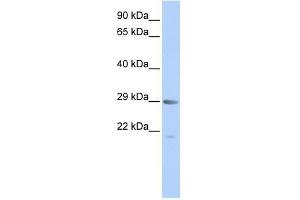 MORF4 antibody used at 0. (MORF4 Antikörper  (Middle Region))