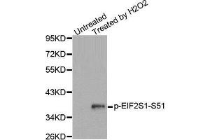 Western blot analysis of extracts from Jurkat cells, using Phospho-EIF2S1-S51 antibody. (EIF2S1 Antikörper  (pSer51))