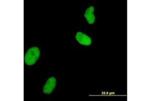 Image no. 2 for anti-Ubiquitin-Like, Containing PHD and RING Finger Domains, 1 (UHRF1) (AA 694-794) antibody (ABIN466202) (UHRF1 Antikörper  (AA 694-794))
