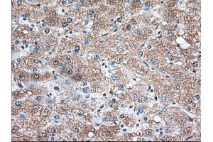 Immunohistochemical staining of paraffin-embedded Human liver tissue using anti-TBXAS1 mouse monoclonal antibody. (TBXAS1 Antikörper)