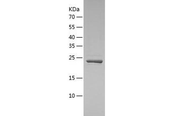 PSMB4 Protein (AA 46-264) (His tag)