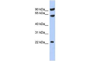 WB Suggested Anti-TIGD3 Antibody Titration:  0. (TIGD3 Antikörper  (Middle Region))