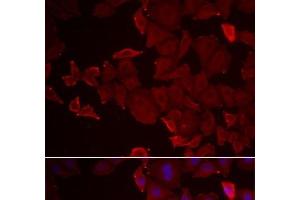 Immunofluorescence analysis of U2OS cells using MARCKSL1 Polyclonal Antibody (MARCKSL1 Antikörper)