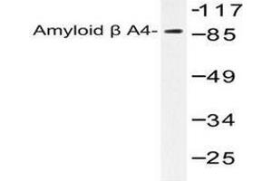 Image no. 1 for anti-Amyloid beta (A4) Precursor Protein (APP) antibody (ABIN265307) (APP Antikörper)