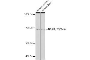 Western blot analysis of extracts of various cell lines, using NF-kB p65/RelA antibody (ABIN7268995) at 1:1000 dilution. (NF-kB p65 Antikörper)