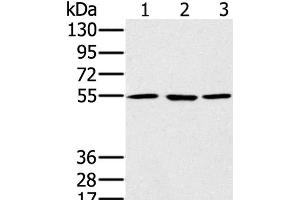 Western Blot analysis of A549, hela and NIH/3T3 cell using PSMC1 Polyclonal Antibody at dilution of 1:500 (PSMC1 Antikörper)