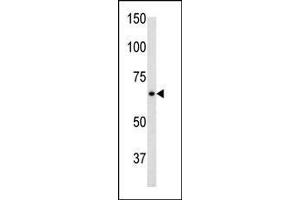 The anti-GF C-term Pab 2017b is used in Western blot to detect GF in mouse brain tissue lysate.