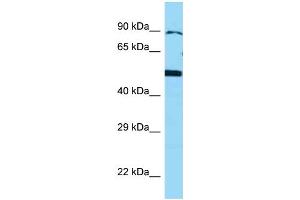 WB Suggested Anti-BMP4 Antibody Titration: 1. (BMP4 Antikörper  (N-Term))