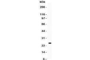 Western blot testing of Kallikrein 4 antibody and recombinant human protein (0. (Kallikrein 4 Antikörper  (AA 31-254))