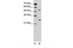 Image no. 2 for anti-Calcium Channel, Voltage-Dependent, beta 1 Subunit (CACNB1) (AA 201-250) antibody (ABIN6736600) (CACNB1 Antikörper  (AA 201-250))