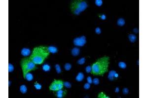 Anti-ARFGAP1 mouse monoclonal antibody (ABIN2454434) immunofluorescent staining of COS7 cells transiently transfected by pCMV6-ENTRY ARFGAP1 (RC206987). (ARFGAP1 Antikörper)