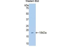 Western blot analysis of the recombinant protein. (Claudin 3 Antikörper  (AA 30-159))