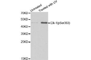 Western Blotting (WB) image for anti-ELK1, Member of ETS Oncogene Family (ELK1) (pSer383) antibody (ABIN1870156) (ELK1 Antikörper  (pSer383))