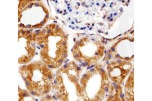 Immunohistochemistry (IHC) image for anti-Ribosomal Protein S6 (RPS6) antibody (ABIN3028983)