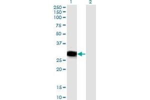 Western Blot analysis of RBPMS expression in transfected 293T cell line by RBPMS monoclonal antibody (M03), clone 1C12.