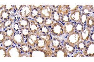 Detection of PKBa in Human Kidney Tissue using Polyclonal Antibody to Protein Kinase B Alpha (PKBa) (AKT1 Antikörper  (AA 122-443))