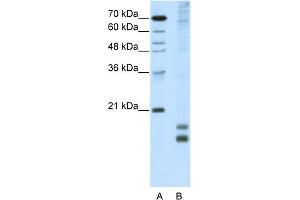 WB Suggested Anti-MAFF Antibody Titration:  5. (MafF Antikörper  (N-Term))
