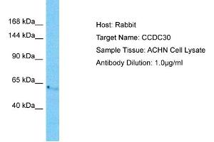 Host: Rabbit Target Name: CCDC30 Sample Tissue: Human ACHN Whole Cell  Antibody Dilution: 1ug/ml
