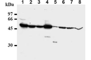 Western Blotting (WB) image for anti-Checkpoint Kinase 1 (CHEK1) antibody (ABIN487487) (CHEK1 Antikörper)