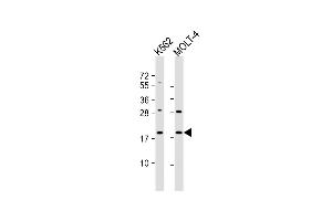 All lanes : Anti-GKN1 Antibody (C-term) at 1:1000 dilution Lane 1: K562 whole cell lysate Lane 2: MOLT-4 whole cell lysate Lysates/proteins at 20 μg per lane.