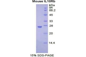 SDS-PAGE analysis of Mouse IL10Rb Protein. (IL10RB Protein)
