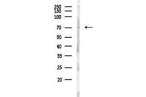 Western blot analysis of lysates from Rat liver, using STR Antibody at 1/1000 dilution.