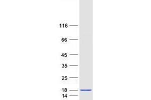 Western Blotting (WB) image for NADH Dehydrogenase (Ubiquinone) 1 alpha Subcomplex, 5, 13kDa (NDUFA5) protein (Myc-DYKDDDDK Tag) (ABIN2726997)