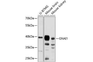 Western blot analysis of extracts of various cell lines, using GN antibody (ABIN6129386, ABIN6141198, ABIN6141199 and ABIN6224811) at 1:3000 dilution. (GNAI1 Antikörper  (AA 1-354))