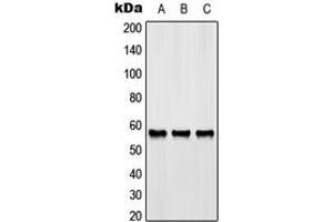 Western blot analysis of GPR176 expression in HeLa (A), SP2/0 (B), rat liver (C) whole cell lysates.