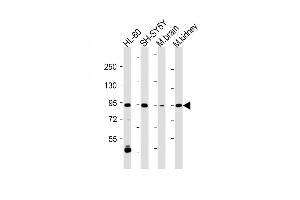 MAP3K12 antibody  (C-Term)