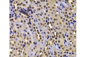 Immunohistochemistry of paraffin-embedded Mouse kidney using WHSC1 Polyclonal Antibody at dilution of 1:100 (40x lens). (WHSC1 Antikörper)
