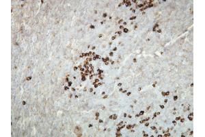 Immunohistochemistry (IHC) image for anti-kappa Light Chain (AA 47-63), (N-Term) antibody (ABIN870362) (kappa Light Chain Antikörper  (N-Term))