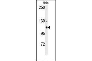 Image no. 1 for anti-Actinin, alpha 4 (ACTN4) (N-Term) antibody (ABIN360099) (alpha Actinin 4 Antikörper  (N-Term))