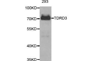 Western Blotting (WB) image for anti-Tudor Domain Containing 3 (TDRD3) antibody (ABIN1877029) (TDRD3 Antikörper)