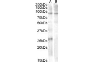 ABIN238679 (1µg/ml) staining of Human Heart lysate (35µg protein in RIPA buffer) with (B) and without (A) blocking with the immunising peptide. (APOBEC2 Antikörper  (AA 12-26))