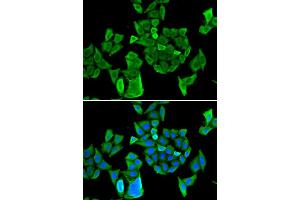 Immunofluorescence (IF) image for anti-Cell Division Cycle and Apoptosis Regulator 1 (CCAR1) antibody (ABIN1980350) (CCAR1 Antikörper)