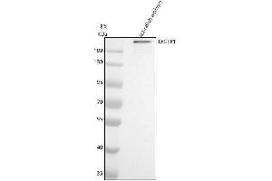 Western blot analysis of DICER1 using anti-DICER1 antibody (AZQ6TV19).