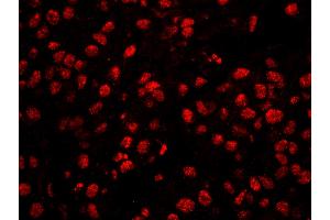 Immunofluorescence (IF) image for anti-Cleavage and Polyadenylation Specific Factor 1, 160kDa (CPSF1) (AA 1392-1442) antibody (ABIN7448944)