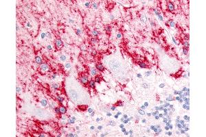 Anti-SLC1A3 / GLAST antibody IHC of human brain, cerebellum, molecular layer and Purkinje layer. (SLC1A3 Antikörper  (Cytoplasmic Domain))
