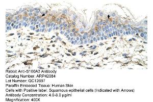 Rabbit Anti-S100A3 Antibody  Paraffin Embedded Tissue: Human Skin Cellular Data: Squamous epithelial cells Antibody Concentration: 4. (S100A3 Antikörper  (N-Term))