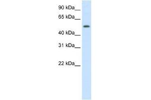 DIDO1 antibody used at 1. (DIDO1 Antikörper  (N-Term))