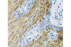 Immunohistochemistry of paraffin-embedded Human esophagus using HGF Polyclonal Antibody at dilution of 1:100 (40x lens). (HGF Antikörper)