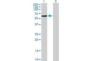 Western Blot analysis of NAP1L2 expression in transfected 293T cell line by NAP1L2 MaxPab polyclonal antibody. (NAP1L2 Antikörper  (AA 1-460))