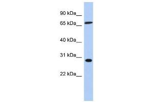 SFRS7 antibody used at 1 ug/ml to detect target protein. (SFRS7 Antikörper  (Middle Region))