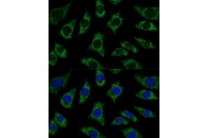 Immunofluorescence analysis of L929 cells using ETFB Polyclonal Antibody (ABIN7266916) at dilution of 1:100 (40x lens). (ETFB Antikörper  (AA 80-230))