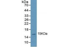 Western Blotting (WB) image for Procollagen I N-Terminal Propeptide (PINP) ELISA Kit (ABIN6574243)