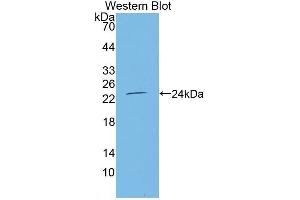 Western Blotting (WB) image for anti-Tumor Necrosis Factor Receptor Superfamily, Member 11a, NFKB Activator (TNFRSF11A) (AA 31-214) antibody (ABIN1863084) (TNFRSF11A Antikörper  (AA 31-214))