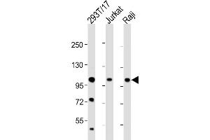 All lanes : Anti-REST Antibody (Center) at 1:2000 dilution Lane 1: 293T/17 whole cell lysate Lane 2: Jurkat whole cell lysate Lane 3: Raji whole cell lysate Lysates/proteins at 20 μg per lane. (REST Antikörper  (AA 542-570))